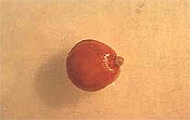 Embrión teñido de Prunus spinosa
